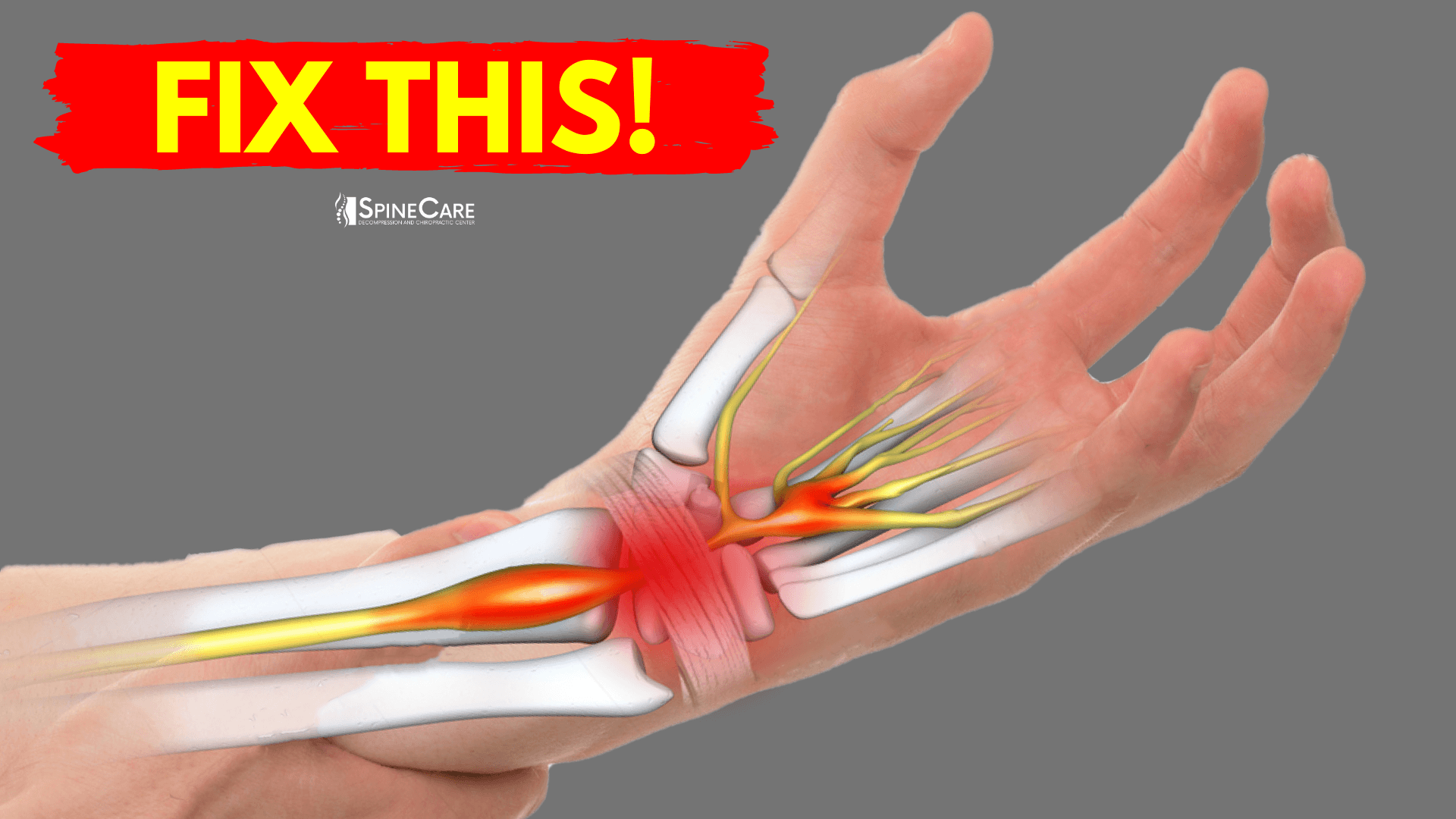 How To Fix Wrist Pain For Good SpineCare St Joseph Michigan